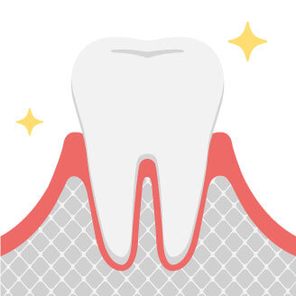 健康的な歯は白く、歯肉は薄いピンク色です