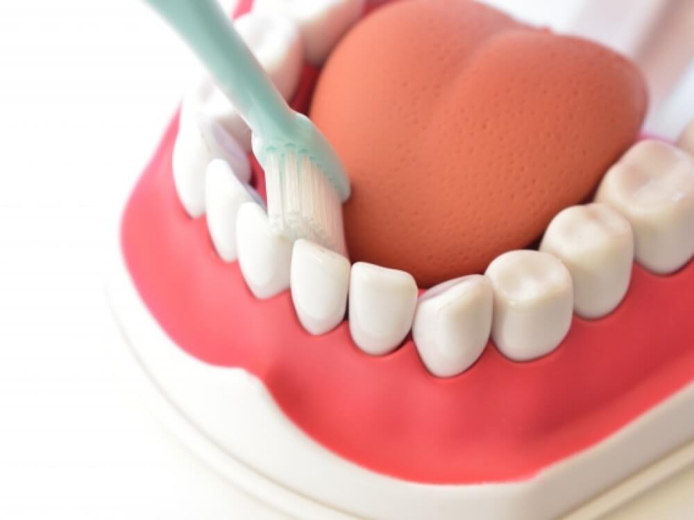 唾液検査で患者さんに合った虫歯予防が可能に！