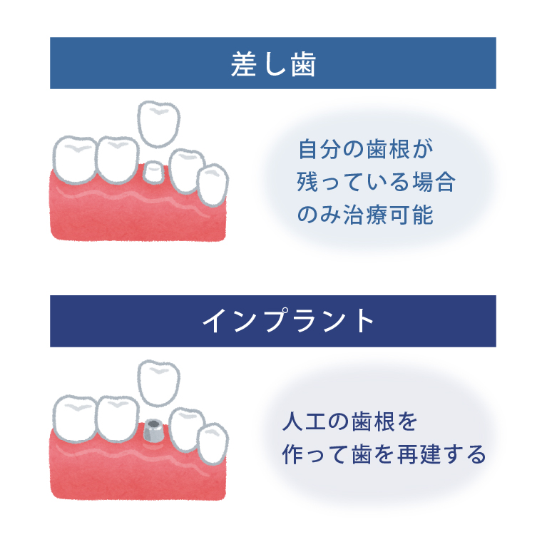 差し歯とインプラントの違い