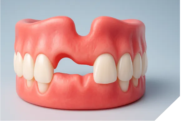 歯が抜けて放置されいる