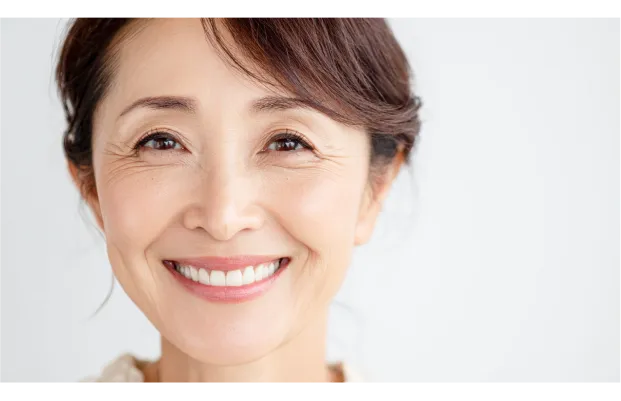インプラント治療をした女性