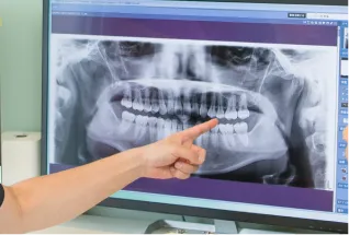 現在の骨の状態