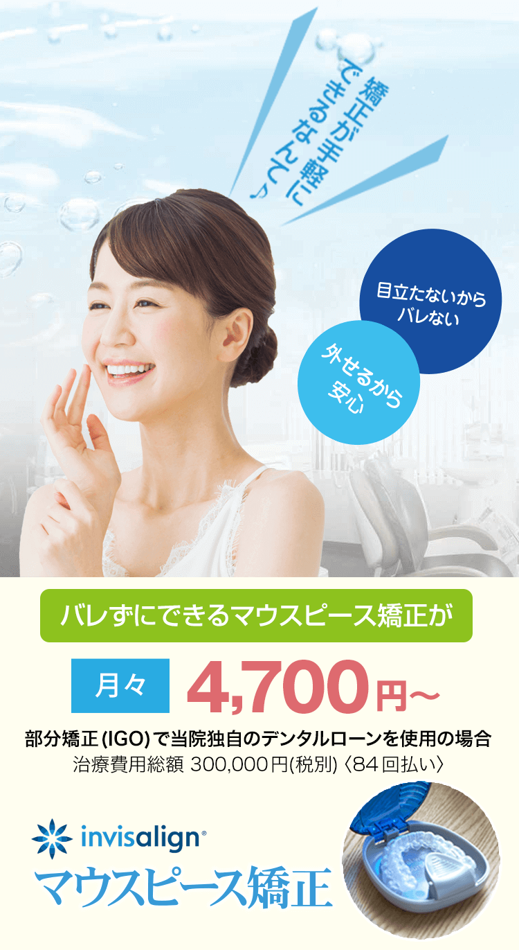 マウスピース矯正